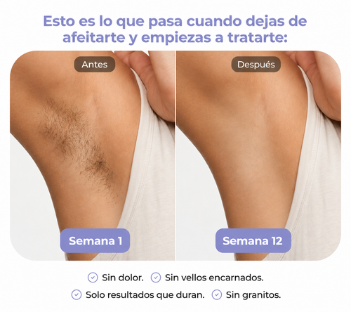 DepilaLux™- Depiladora laser